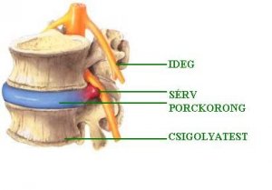 gerincserv_porckorongserv